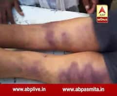 dalit youth thrashed to death in raipur