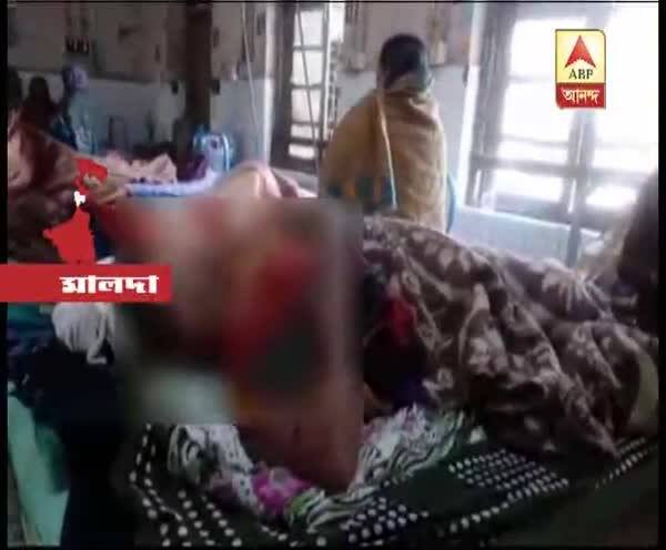  মালদা: স্বামীর সঙ্গে বিবাদের জেরে গৃহবধূকে বিবস্ত্র করে মারধরের অভিযোগ শ্বশুরবাড়ির বিরুদ্ধে