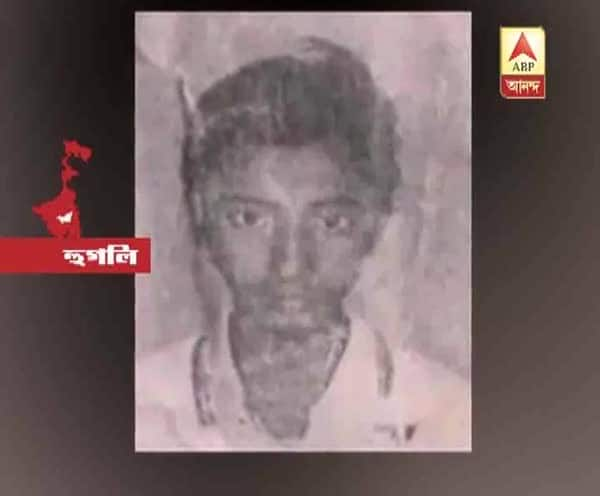  চুঁচুড়ায় পিকনিক সেরে ফেরার পথে গুলিবিদ্ধ কিশোর