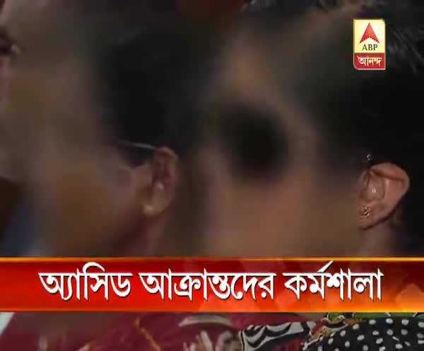  অ্যাসিড আক্রান্তদের কর্মশালা