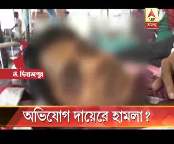  অভিযোগ দায়েরে হামলা?