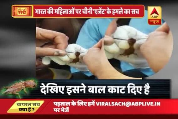 Viral Sach: Did China send this bug to attack Indian women and chop-off their braids?