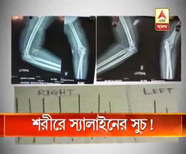  গৃহবধূর শরীরে স্যালাইনের পনেরোটি সূচ!