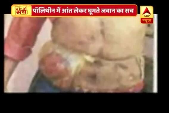 Viral Sach: CRPF jawan forced to carry intestines in a plastic bag
