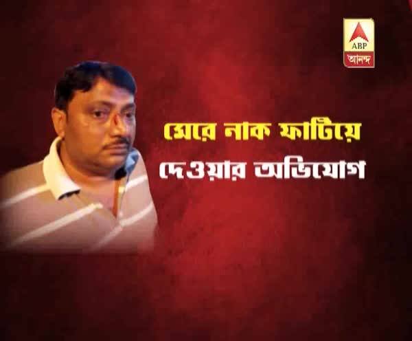  সোনারপুরে সাইকেল আরোহীর নাক ফাটিয়ে দেওয়ার অভিযোগ, গ্রেফতার ক্যাব চালক