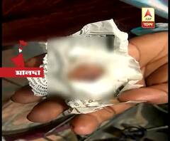 Panchayat Clash: Congress supporter tears TMc worker\'s nose, creates controversy