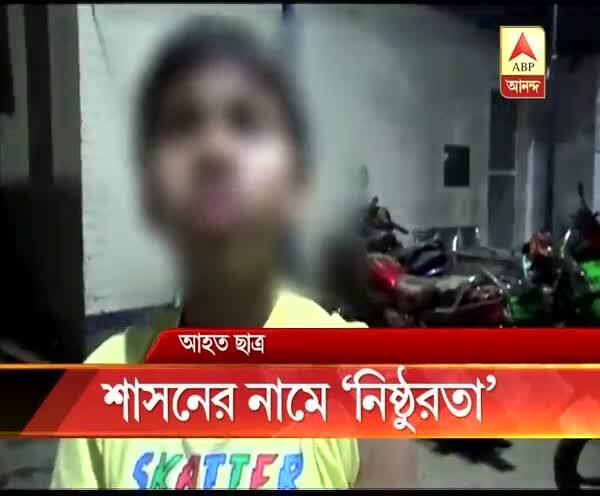  হোমওয়ার্কের খাতা আনতে ভুলে যাওয়ায় পঞ্চম শ্রেণির ছাত্রকে বেত দিয়ে বেধড়ক মার গৃহশিক্ষিকার