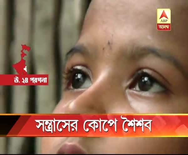  রাজনৈতিক হিংসার শিকার শৈশব:  বোমায় হাত হারিয়ে ছোট্ট পৌলমি বলছে, 'দুষ্টু লোকেরা নিয়ে চলে গেছে'