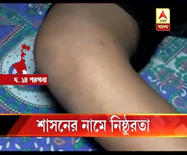  দক্ষিণ ২৪ পরগনা: বই হারিয়ে ফেলায় গাছের ডাল দিয়ে তৃতীয় শ্রেণির ছাত্রীকে ‘বেধড়ক মারধর’, অভিযুক্ত গৃহশিক্ষিকা