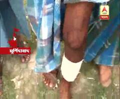 Panchayat Election: This voter got injured on Monday, but again came today to cast his democratic right 