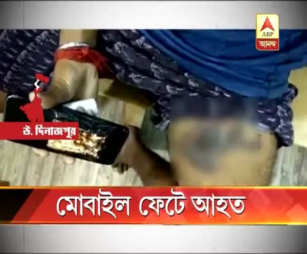  উত্তর দিনাজপুরের কালিয়াগঞ্জে মোবাইল ফোন বিস্ফোরণ, জখম যুবক