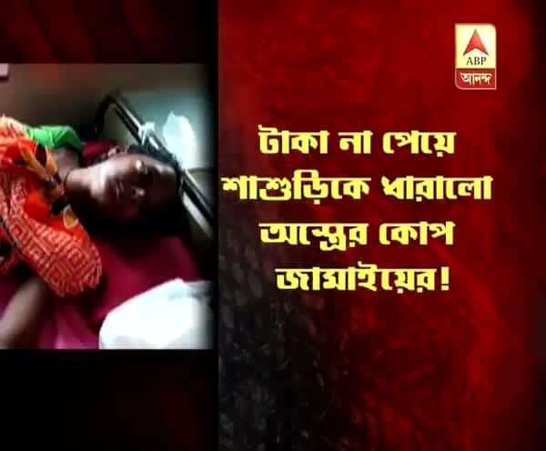  উত্তর ২৪ পরগনা: টাকা চেয়ে না পাওয়ায় শাশুড়িকে ‘কোপ’ জামাইয়ের