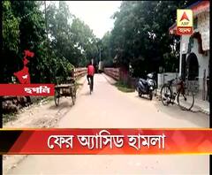 হুগলির পাণ্ডুয়ায় যুবকের ওপর অ্যাসিড হামলার অভিযোগ