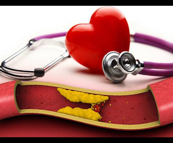 কোলেস্টেরলেও খাওয়া যায় ডিম-মাংস?