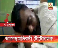 মত্ত অবস্থায় গালিগালাজের প্রতিবাদ করায় টোটোচালককে ‘ধারালো অস্ত্রের কোপ’