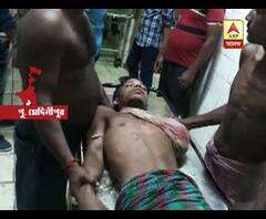 মেশিনের মধ্যে ঢুকে যাওয়ায় বাদ গেল হাত