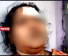 মদের আসর বসানো ও মত্ত অবস্থায় গালিগালাজের প্রতিবাদ করায় দেওরের হাতে আক্রান্ত বিধাননগর কমিশনারেটের এসআই-এর স্ত্রী, নাবালক ভাইপো
