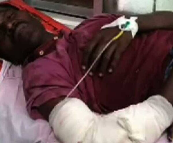 জলপাইগুড়িতে রেললাইনের পাশে হাত-পা কাটা অবস্থায় পড়ে ৩ ঘণ্টা পড়ে রইলেন আহত, বীরভূমে প্ল্যাটফর্মেই মৃত্যু প্রৌঢ়ের, দেহ উদ্ধারে লাগল আট ঘণ্টা জলপাইগুড়িতে রেললাইনের পাশে হাত-পা কাটা অবস্থায় পড়ে ৩ ঘণ্টা পড়ে রইলেন আহত, বীরভূমে প্ল্যাটফর্মেই মৃত্যু প্রৌঢ়ের, দেহ উদ্ধারে লাগল আট ঘণ্টা