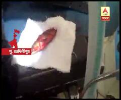 তমলুকে যুবকের গলায় আটকে গেল জ্যান্ত কইমাছ, অস্ত্রোপচারের পর সুস্থ