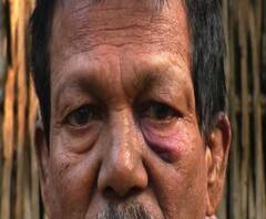 নদিয়ায় চাষের জমি দখল ঘিরে বৃদ্ধকে মারধরের অভিযোগ তৃণমূল পঞ্চায়েত প্রধানের স্বামী ও অনুগামীদের বিরুদ্ধে