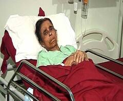 ব্যাক্টিরিয়া দিয়ে ব্যাক্টিরিয়া নিধন, চিকিৎসায় রক্ষা পেলেন বৃদ্ধা