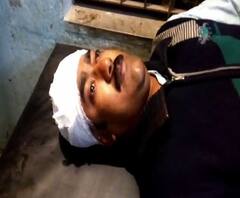 পূর্ব বর্ধমানের জামালপুরে তৃণমূলের গোষ্ঠীদ্বন্দ্ব, পঞ্চায়েত সমিতির সদস্যকে মারধর, অভিযোগ পঞ্চায়েত সমিতির সভাপতির অনুগামীদের বিরুদ্ধে