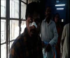 কাজ না করেও টাকা দাবি, বিল পাস না করায় দুবরাজপুরের বালিজুড়িতে নির্মাণ সহায়ককে মেরে নাক ফাটিয়ে দেওয়ার অভিযোগ তৃণমূল কর্মী ঠিকাদারের বিরুদ্ধে