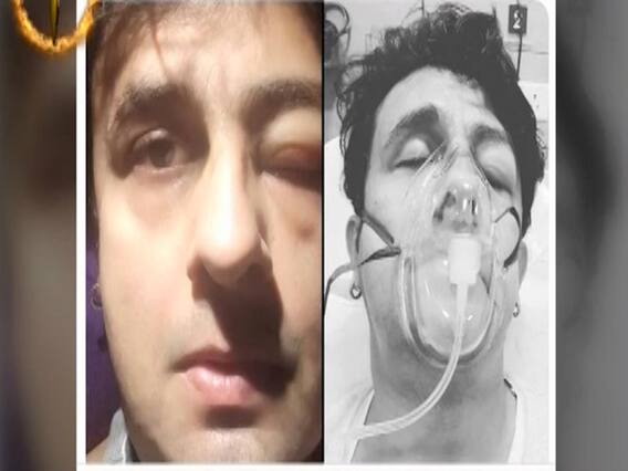 बाहर का खाना खाकर सिंगर सोनू निगम की तबियत बिगड़ी, दो दिन तक अस्पताल के ICU में होना पड़ा एड्मिट