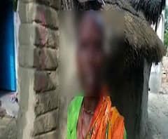 বীরভূমের পাড়ুইয়ে বিজেপি কর্মীদের মারধর, আগ্নেয়াস্ত্র দেখিয়ে হুমকি দেওয়ার অভিযোগ তৃণমূলের বিরুদ্ধে, আহত ৫ বিজেপি কর্মী
