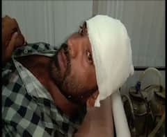 ক্যানিংয়ের দুটি গ্রামে পতাকা লাগানো ও দেওয়াল লিখনে কালি লেপার অভিযোগকে কেন্দ্র করে তৃণমূল-বিজেপি সংঘর্ষ, আহত ৬
