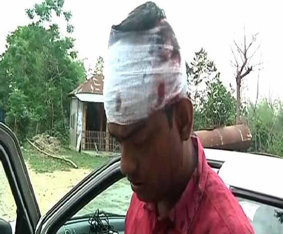 গোয়ালপোখরের কাটা ফুলবাড়িতে ভোটারদের ভোটদানে বাধা দেওয়ার অভিযোগ, ঘটনাস্থলে গিয়ে আক্রান্ত এবিপি আনন্দর সাংবাদিক পার্থপ্রতিম ঘোষ ও চিত্র সাংবাদিক স্বপন মজুমদার