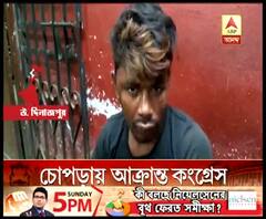 চোপড়ার লক্ষ্মীপুরে কংগ্রেস কর্মীকে রড-লাঠি দিয়ে বেধড়ক মারের অভিযোগ, অস্বীকার তৃণমূলের