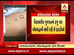 અંધશ્રદ્ધા- બનાસકાંઠામાં માતા-પિતાએ બિમાર બાળકને ડામ આપ્યા, જુઓ વીડિયો 