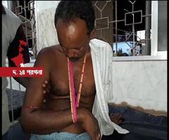 ক্যানিংয়ে কাটমানির অভিযোগ করায় বিজেপি কর্মীকে মেরে হাত ভেঙে দেওয়ার অভিযোগ তৃণমূলের বিরুদ্ধে