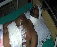 সোনারপুরে আক্রান্ত তৃণমূল কর্মী, গলায় পেটে ও মুখে ধারাল অস্ত্রের কোপ