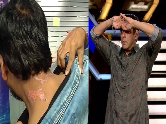 Bigg Boss 13: Siddharth Dey की जली स्किन देख Salman पर फूटा फैंस का गुस्सा, लगाया पक्षपात का आरोप