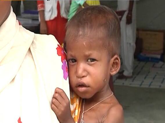 बच्चे दुबले, दावे मोटे... देखिए कहानी 'भ्रष्टाचार' की ! भारत मां के बच्चों पर बुरी नजर लगाने वालों की घंटी बजाओ