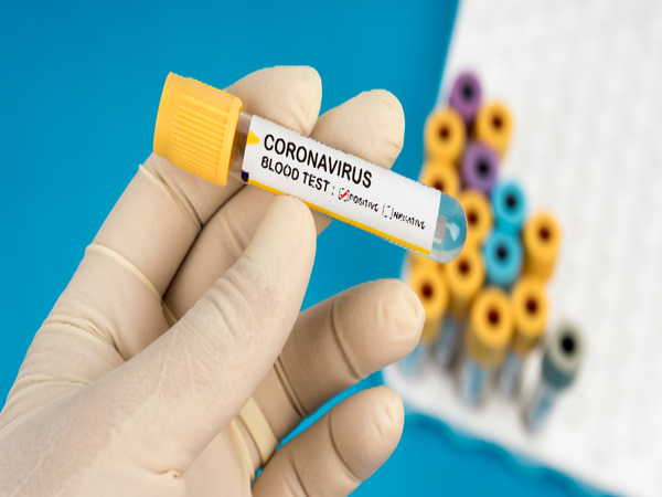 Number of Coronavirus positive cases crosses 19 lakh mark in America